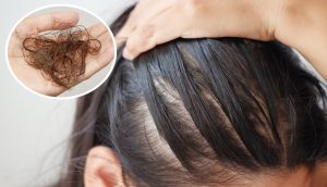 Hair Gleem contraindicații are efecte secundare, studii clinice