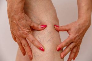 Normacelin  Pareri - forum, pareri reale ale utilizatorilor