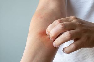 Worlex contraindicații are efecte secundare, studii clinice